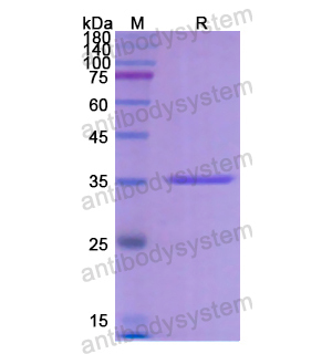 Recombinant Human CYP21A2, N-His