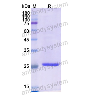 Recombinant Human IGFBP1, N-His