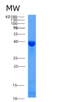 Recombinant Mouse GFOD2 Protein (His Tag)