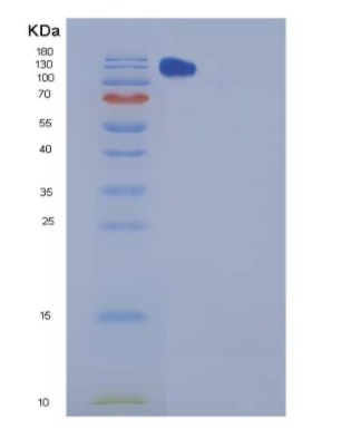 Recombinant Mouse CHL-1 Protein (Fc tag)