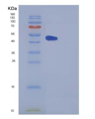 Recombinant Human Carboxypeptidase E / CPE Protein (His tag)