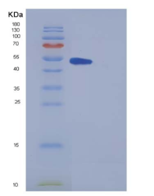 Recombinant Mouse METAP2 / MAP2 Protein (His tag)
