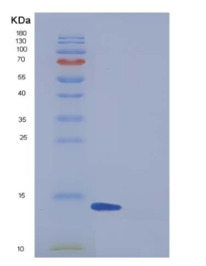 Recombinant Human FABP6 / I-BABP Protein