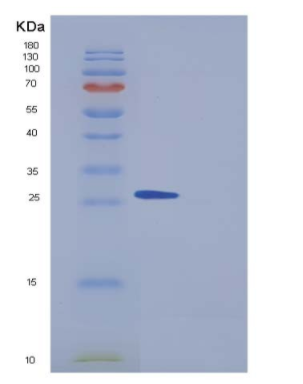 Recombinant Human PPM1G / PP2C-gamma Protein (aa 317-546, His tag)