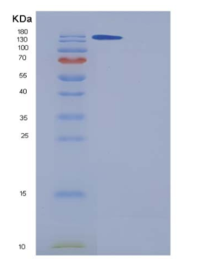 Recombinant Human A2M / CPAMD5 / Alpha-2-macroglobulin Protein (His tag)