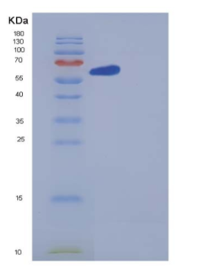 Recombinant Human GBP1 Protein (His tag)