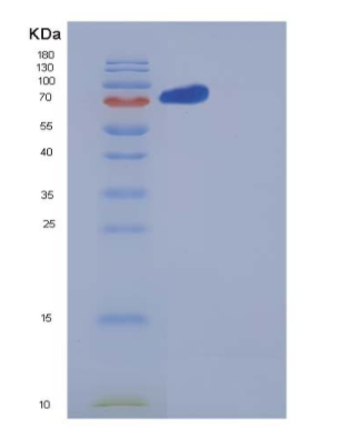 Recombinant Human Neuropilin-2 / NRP2 Protein (His tag)