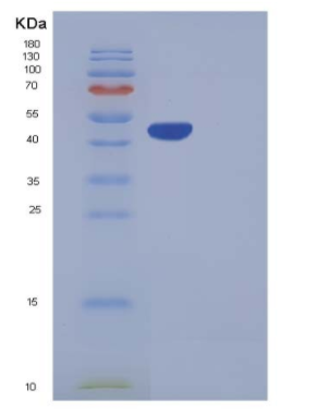 Recombinant Human Carboxypeptidase A2 / CPA2 Protein (His tag)