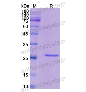 Recombinant Human ACAA1, N-His