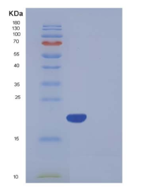 Recombinant Human BNIP3L Protein