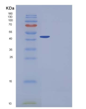 Recombinant Mouse Carboxypeptidase A1 / CPA1 Protein (His tag)