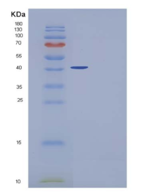 Recombinant Human PLA2G2D / Phospholipase A2 IID Protein (Fc tag)