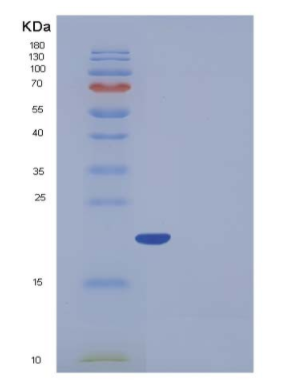 Recombinant Human Ferritin light chain Protein (His Tag)