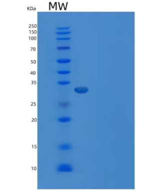 Recombinant Human LMAN2 Protein (His Tag)