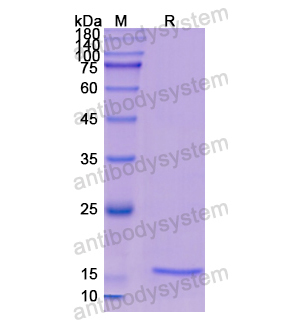 Recombinant Human CST2, N-His