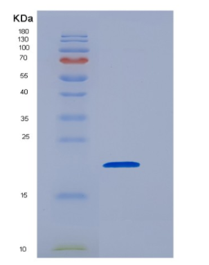 Eukaryotic Cluster Of Differentiation 8a (CD8a)