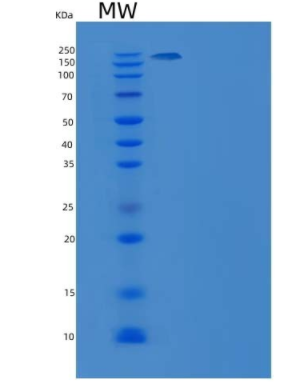 Recombinant Human XRCC5 & XRCC6 Heterodimer Protein