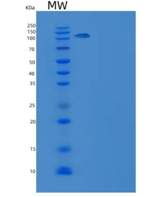 Recombinant Human C6 / complement component 6 Protein (His tag)