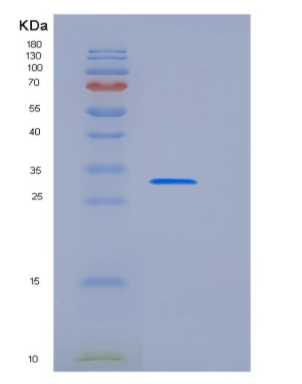 Recombinant Human LYPLA2 Protein (His Tag)