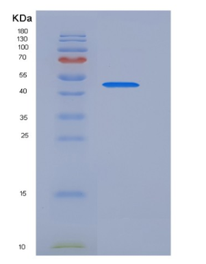 Recombinant Human PDK-1 Protein (His tag)