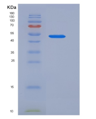 Recombinant Mouse SerpinA10 / ZPI Protein (His tag)
