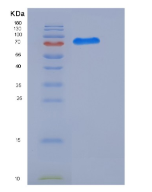 Recombinant Human CDK16 / PCTAIRE1 / PCTK1 Protein (GST tag)