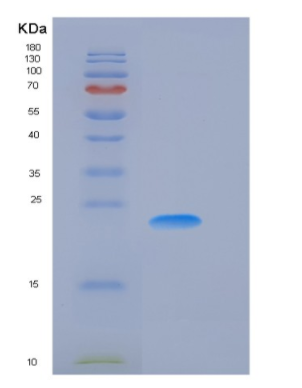 Recombinant Human CSRP1 Protein (His tag)