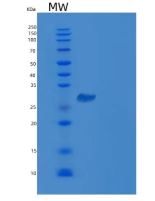 Recombinant Human CLIC4 Protein (His Tag)