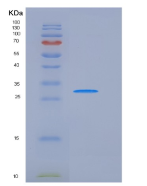 Recombinant Human Carbonic Anhydrase XIII / CA13 Protein (His tag)