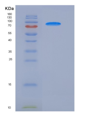 Recombinant Rat VEGFR2 / Flk-1 / CD309 / KDR Protein (His tag)