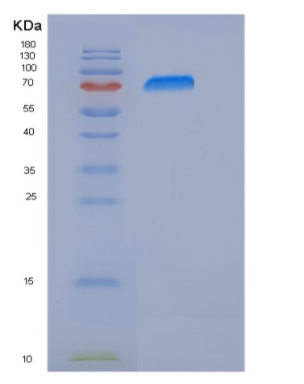 Recombinant Human PARP-3 / PARP3 Protein (His & GST tag)