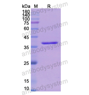 Recombinant Human FBP1, N-His