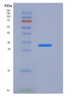 Recombinant Human Carbonic Anhydrase XIV / CA14 Protein (His tag)