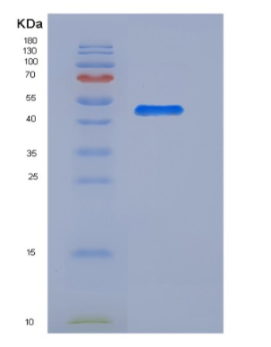 Recombinant Rat Angiotensinogen / SerpinA8 / AGT Protein (His Tag)