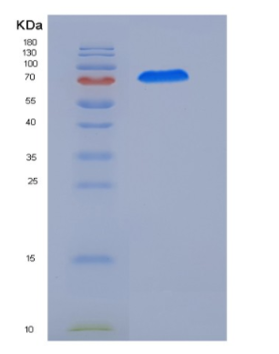 Recombinant Human CAMKV Protein (His & GST tag)