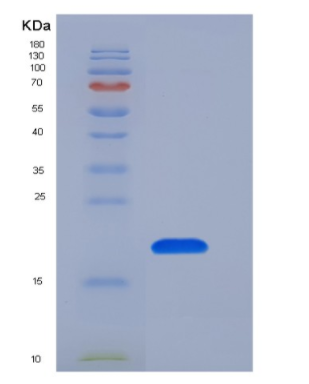 Recombinant Human GKN1 / Gastrokine 1 Protein (His tag)