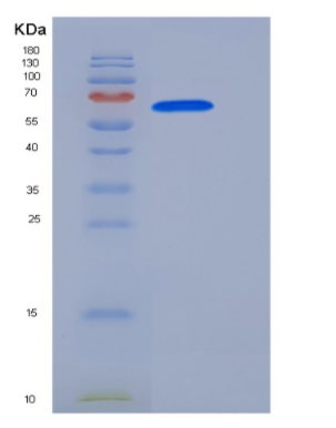 Recombinant Human FAM20C / DMP4 Protein (His Tag)