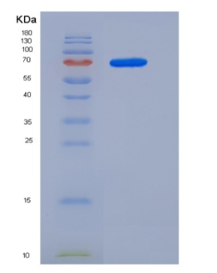 Recombinant Mouse MEK1 / MAP2K1 / MKK1 Protein (His & GST tag)