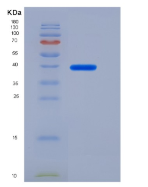 Recombinant Rat IL-6R / CD126 Protein (ECD, His tag)