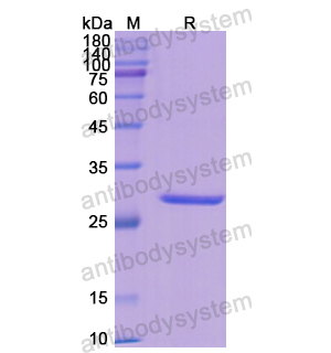 Recombinant Human GSTM1, N-His