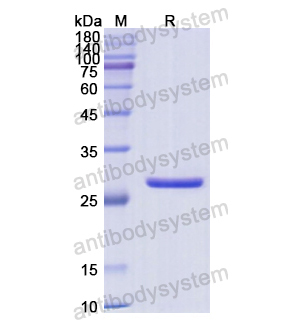 Recombinant Human CLTB, N-His