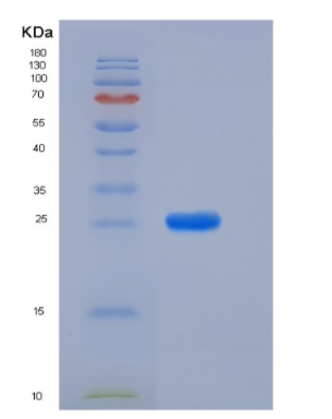 Recombinant Rat PRL8A4 Protein (His Tag)