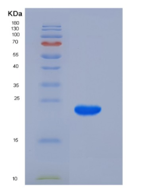 Recombinant Human K-Ras / K-Ras Protein (His tag)