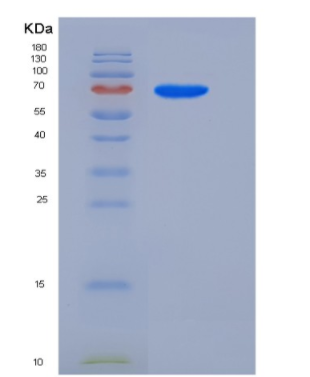 Recombinant Human Semaphorin 6A / SEMA6A Protein (His tag)