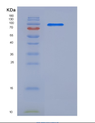 Recombinant Human SRPK1 Protein (His & GST tag)