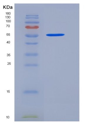 Recombinant Human Alkaline Phosphatase / ALPL Protein (His tag)