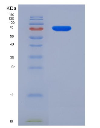 Recombinant Mouse SCARB1 / CD36L1 / CLA-1 Protein (His & Fc tag)