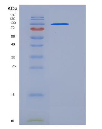 Recombinant Mouse ACO2 / Aconitase 2 Protein (His & GST tag)