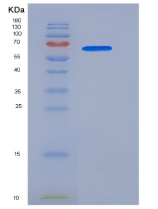 Recombinant Human p38 delta / MAPK13 Protein (GST tag)