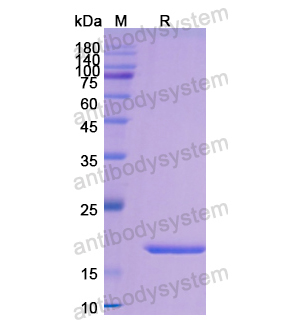 Recombinant Human CD7, N-His